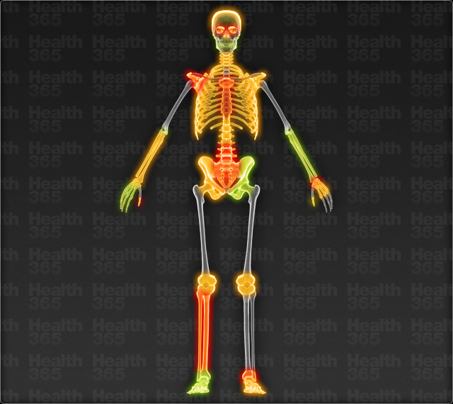 Ouch Map - skeleton Ouch Map - skeleton